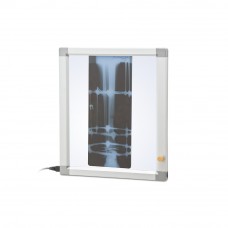 Негатоскоп  общего назначения 